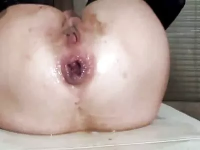 வெறும் வெட்டுக்களுடன் படுக்கையில் புகைத்தல்